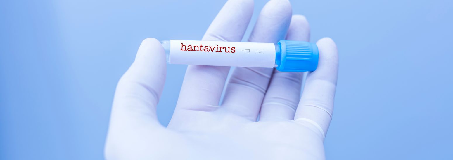Hantavirus: educación sanitaria y medidas de prevención